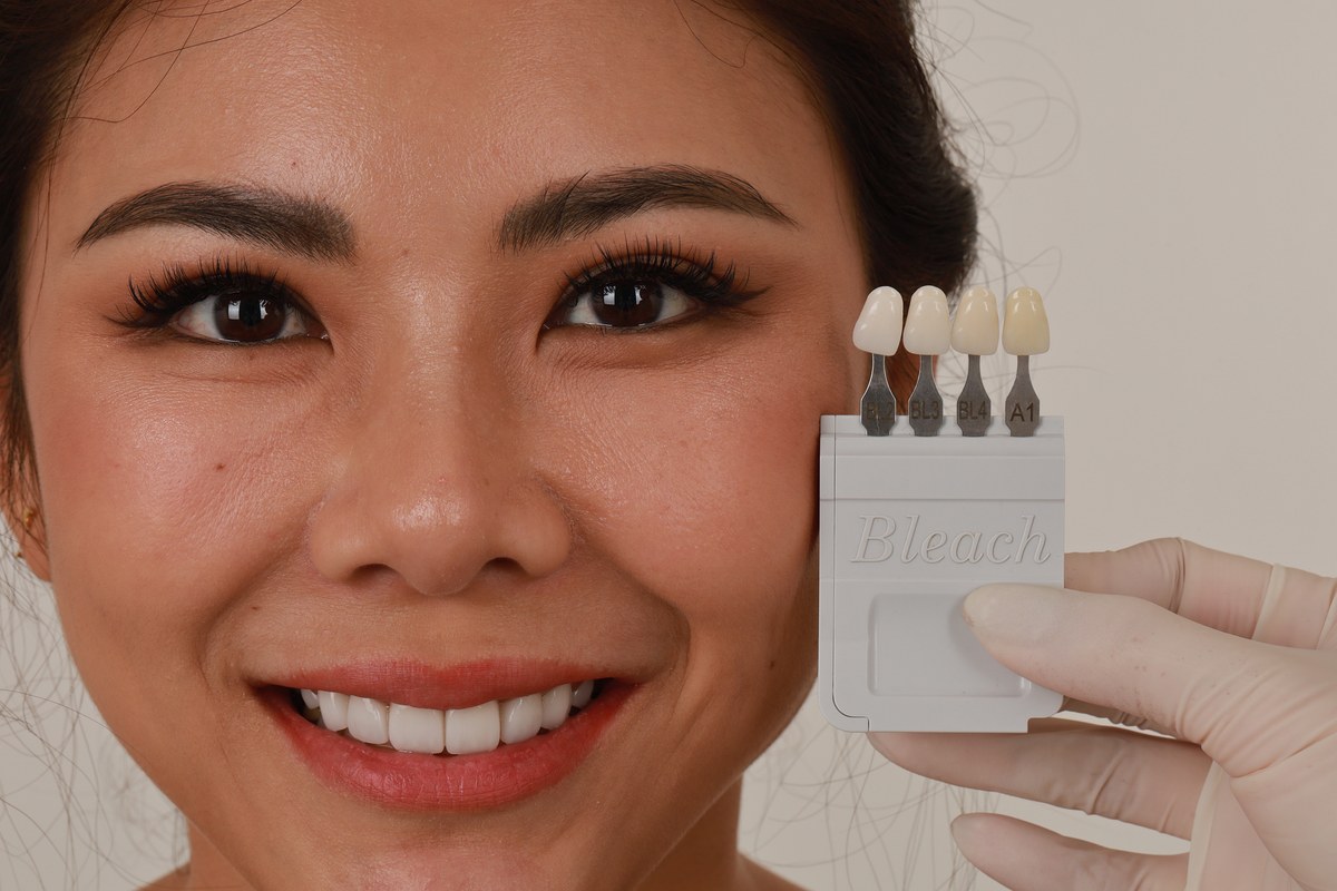 Shade tabs held beside a patient's face to match veneer brightness to her own eyes and skin tone