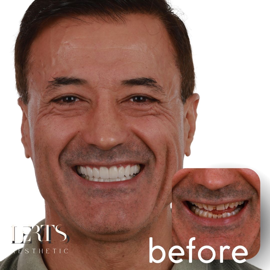 Symmetry, restored
