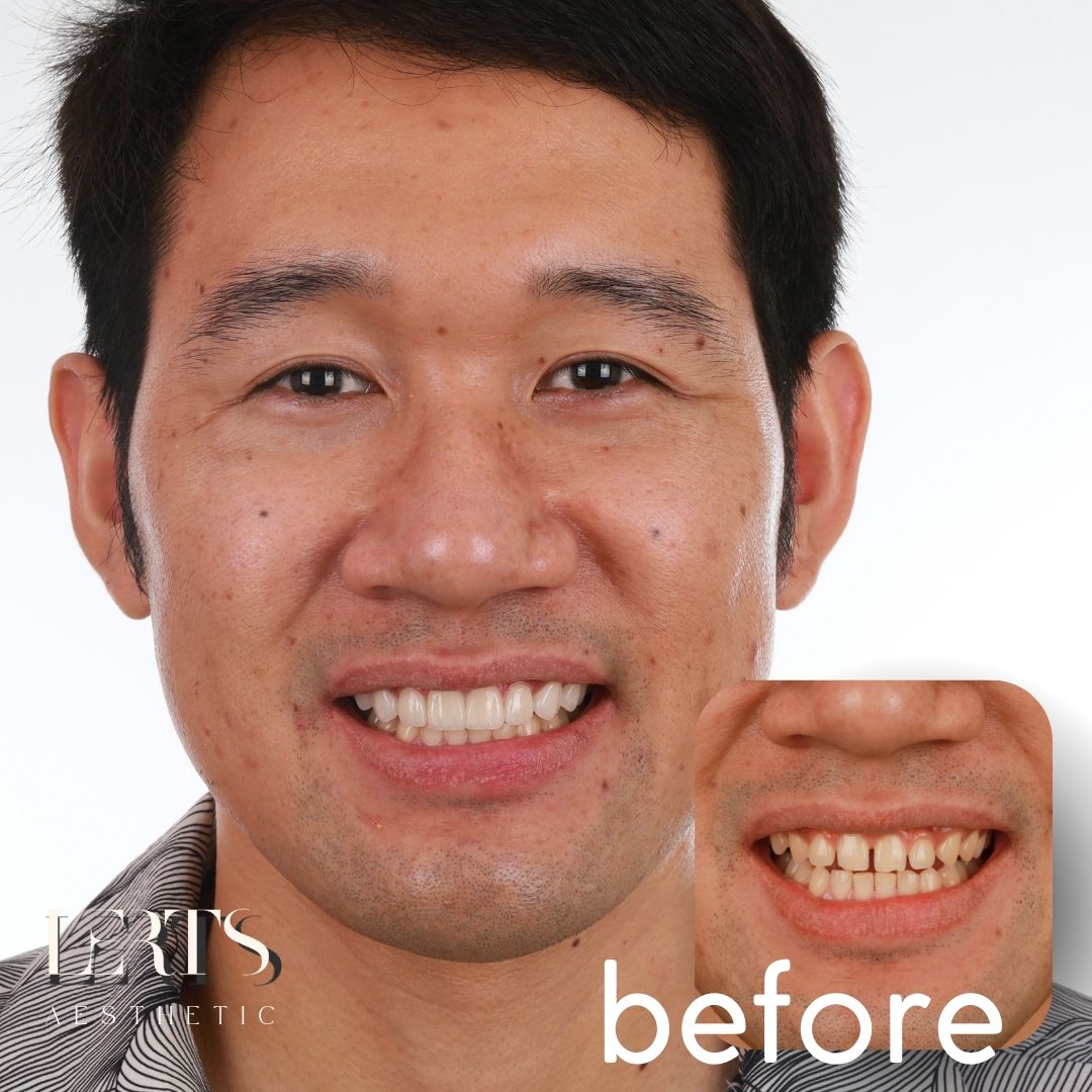 Re-shaped and renewed